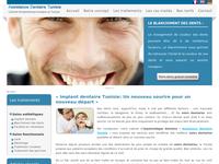 Détails : Implant dentaire Tunisie